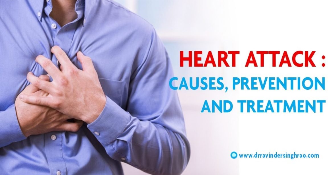 Heart Attack Causes, Prevention and Treatment – Dr. Ravinder Singh Rao