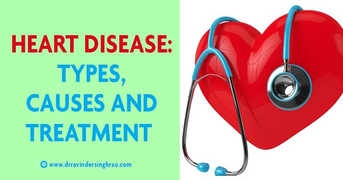 Heart Disease Types, Causes, Treatments, Risk Factors and Symptom