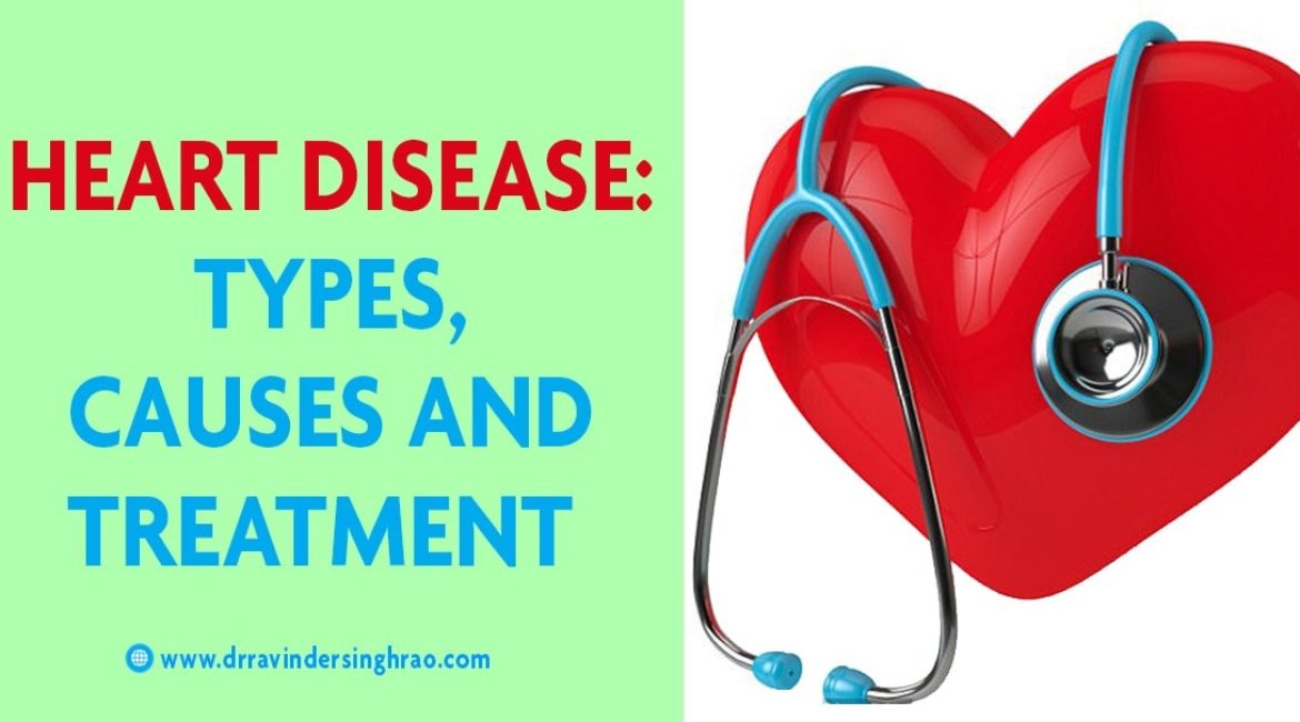 Heart Disease- Types | Causes | Treatments | Risk Factors | Symptoms