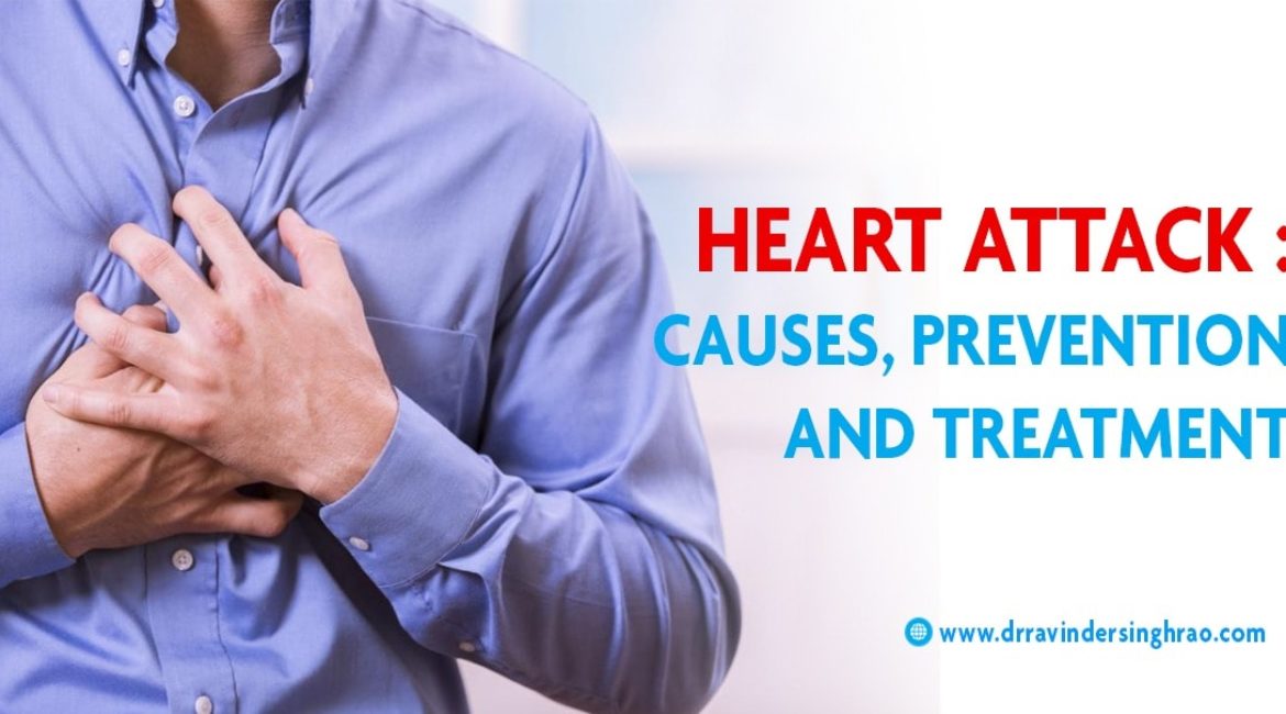 Heart Attack- Causes | Prevention and Treatment  | Best Heart Attack Specialists In Delhi- Dr. Ravinder Singh