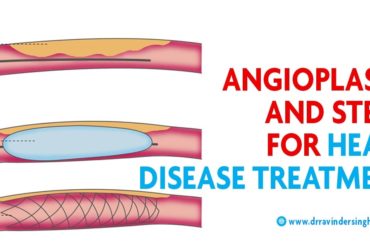 Coronary Angioplasty and Stent Placement for the Heart