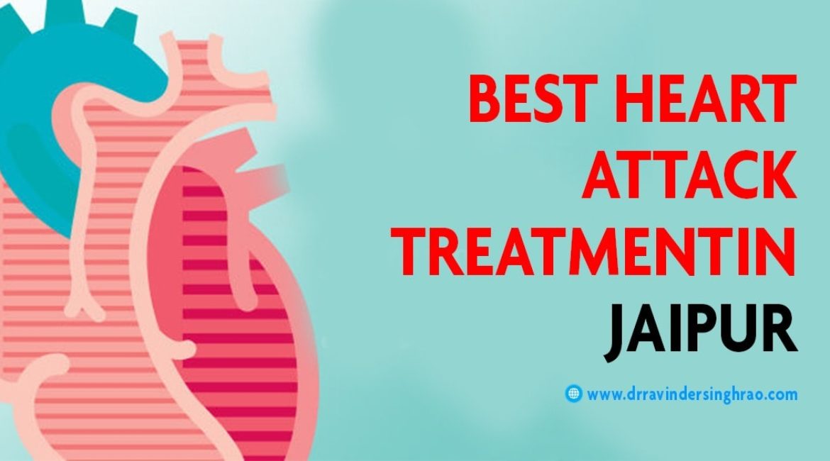 Best Heart Attack Treatment in Jaipur – Dr. Ravinder Singh Rao