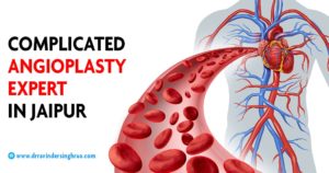 Complicated Angioplasty Expert in Jaipur