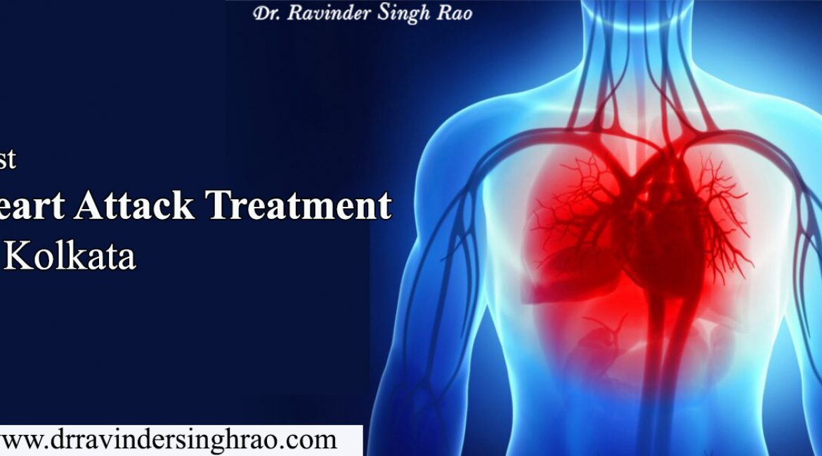Best Heart Attack Treatment in Kolkata – Dr. Ravinder Singh Rao
