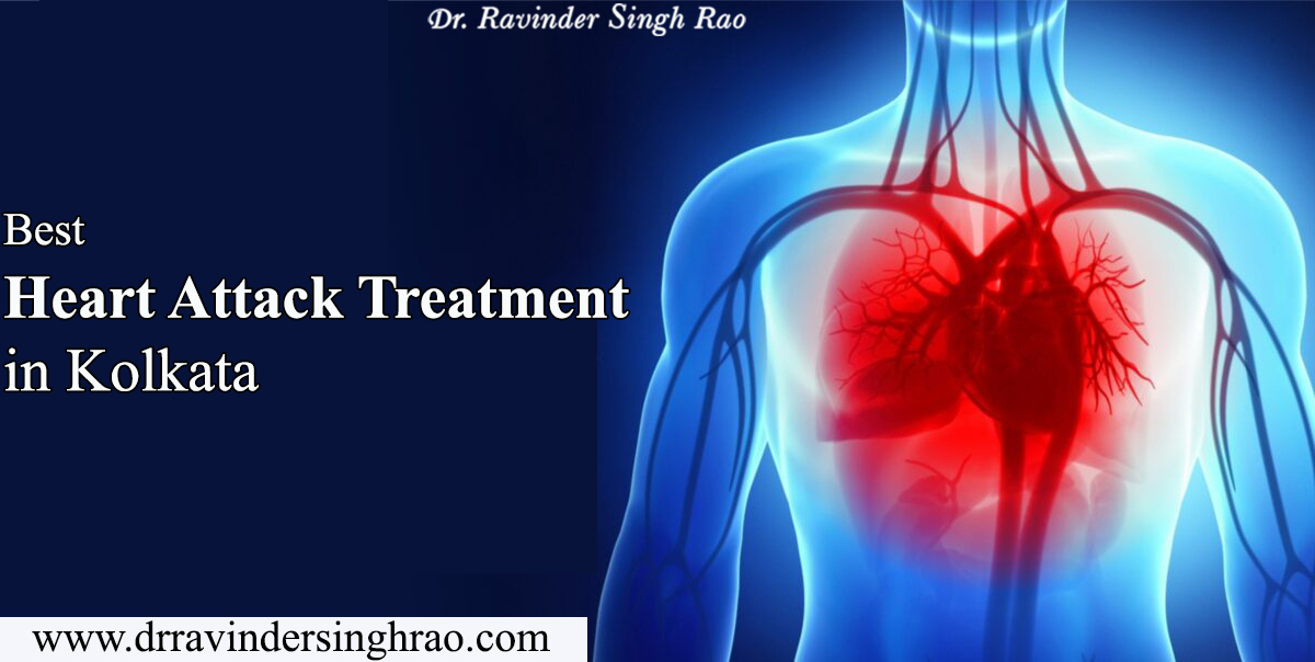 Best Heart Attack Treatment in Kolkata | Best Heart Expert in India