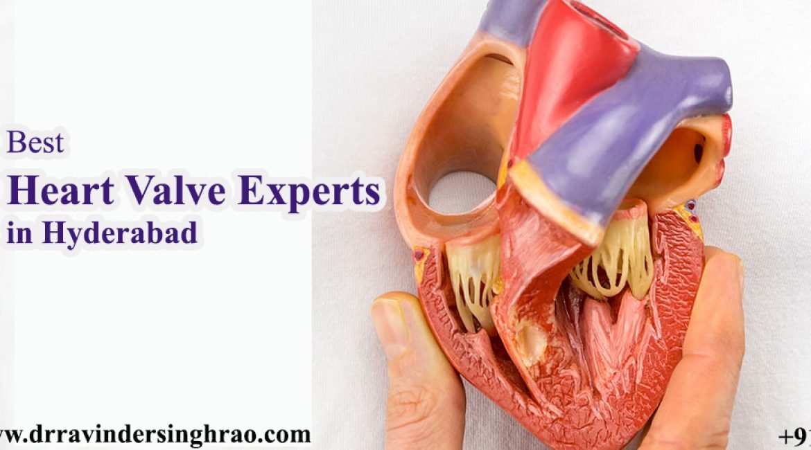 Best Heart Valve Experts in Hyderabad