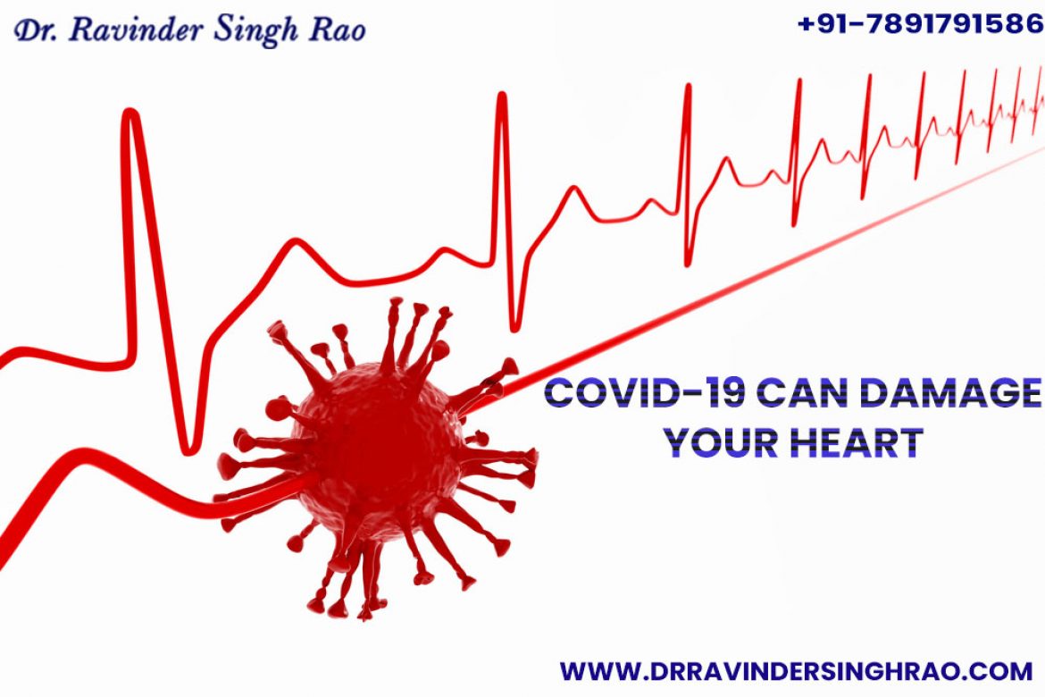 COVID-19 Can Damage Your Heart | Angioplasty Expert in India