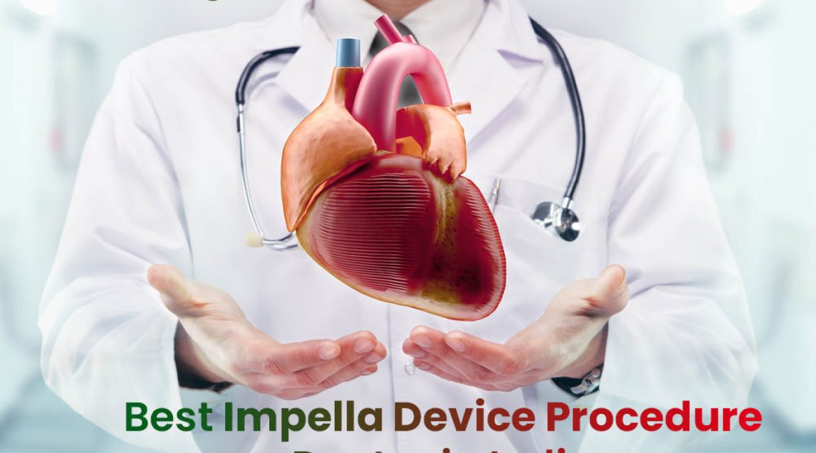 Best Impella Device Procedure Doctor in India | Heart Angioplasty Expert in Delhi
