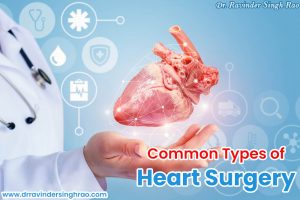 Common Types of Heart Surgery