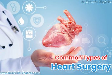 Common Types of Heart Surgery | Best Heart Expert in India