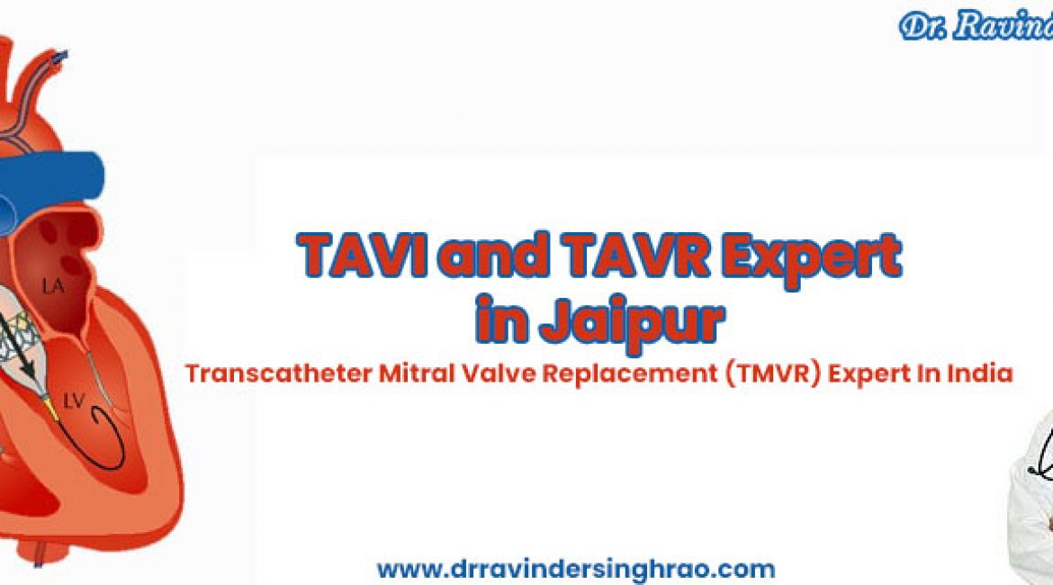 TAVI and TAVR Expert in India | Heart Valve Expert in Delhi, Gujarat