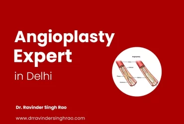 Best Angioplasty Expert in Delhi – Dr. Ravinder Singh Rao