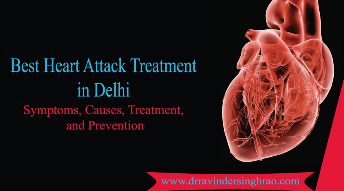 Best Heart Attack Treatment in Delhi- Symptoms | Causes | and Prevention