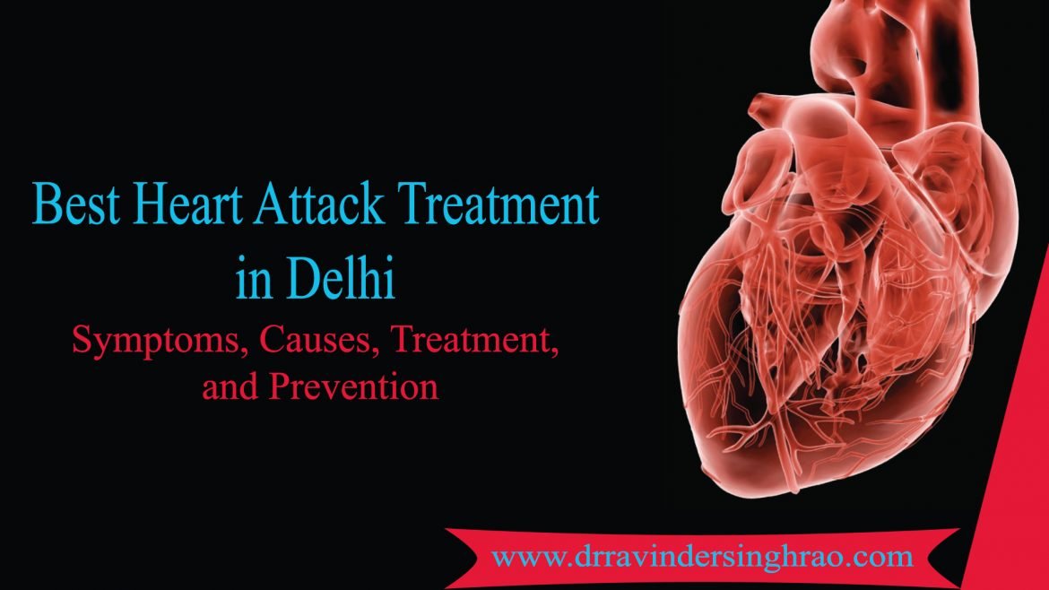 Best Heart Attack Treatment in Delhi- Symptoms | Causes | and Prevention