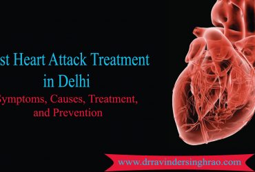 Best Heart Attack Treatment in Delhi- Symptoms, Causes, and Prevention