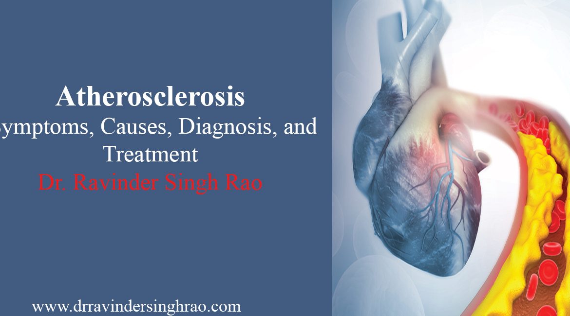 Atherosclerosis- Symptoms | Causes | Diagnosis | and Treatment | Angioplasty Expert