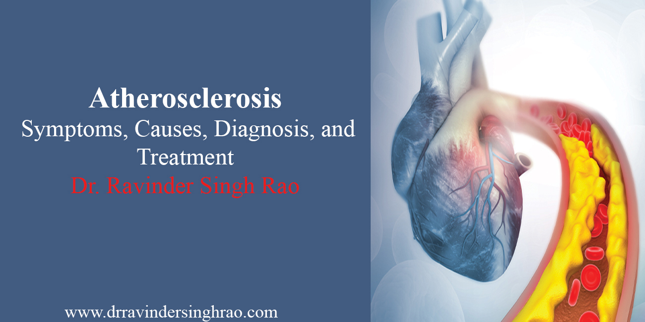 Atherosclerosis- Symptoms | Causes | Diagnosis | Treatment | Angioplasty Expert