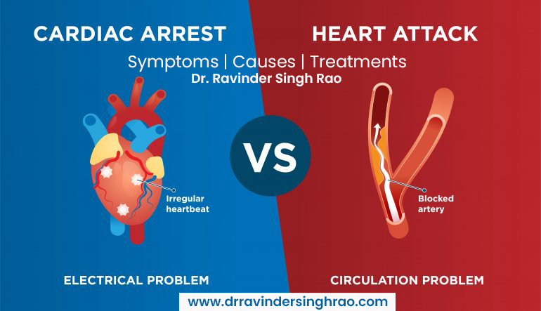 Difference between Heart Attack and Cardiac Arrest | Symptoms | Causes | Treatments- Heart and Cardiologist Expert