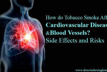 How do Tobacco Smoke Affect Cardiovascular Diseases and Blood Vessels? Side Effects and Risks