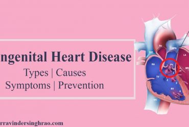 Congenital Heart Disease- Types | Causes | Symptoms | Prevention