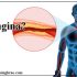 What is Angina? Symptoms | Causes | Treatment