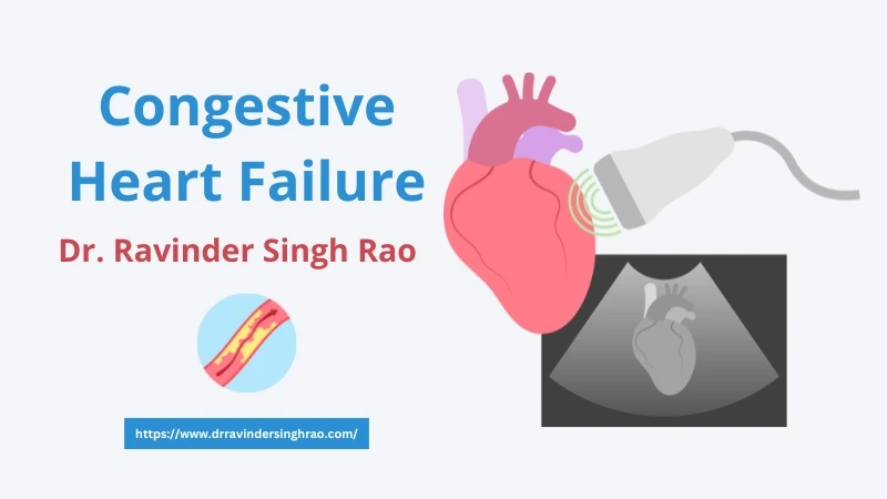 Congestive Heart Failure – Dr. Ravinder Singh Rao