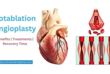 Rotablation Angioplasty – Benefits, Treatments, and Recovery Time