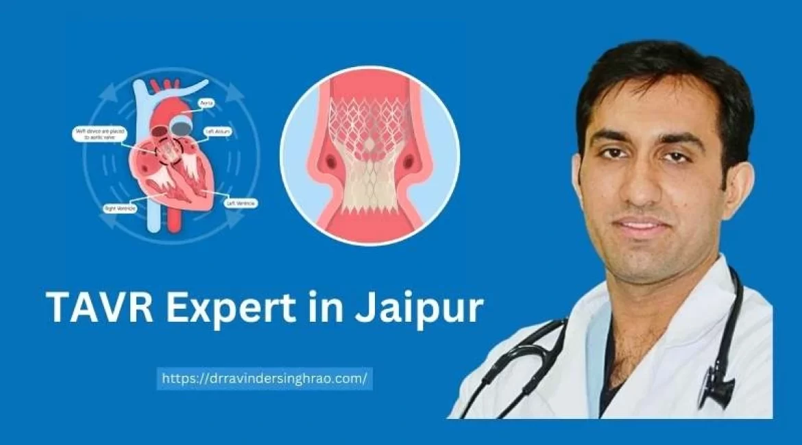 TAVR Expert in Jaipur – Dr. Ravinder Singh Rao