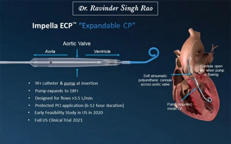 What is an Impella Heart Pump: How it Works, Risk and Benefits, and Procedure