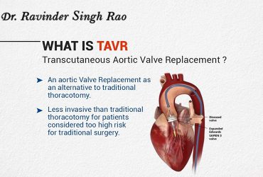 TAVR: Transcatheter Aortic Valve Replacement Without Open-Heart Surgery
