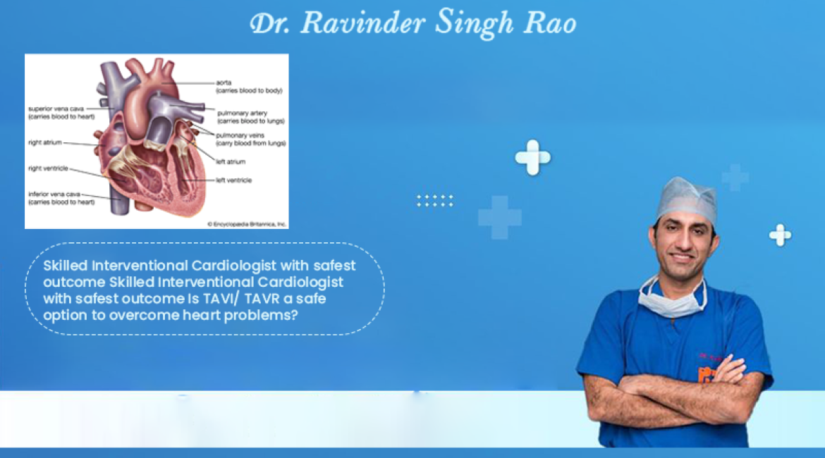 Skilled Interventional Cardiologist with safest outcome – Dr Ravinder Singh Rao