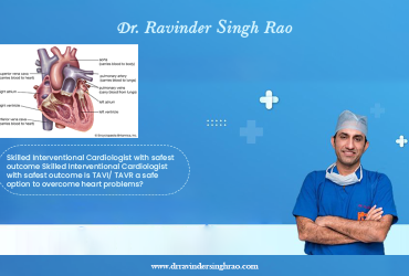 Skilled Interventional Cardiologist with safest outcome – Dr Ravinder Singh Rao
