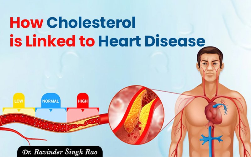How Cholesterol is Linked to Heart Disease