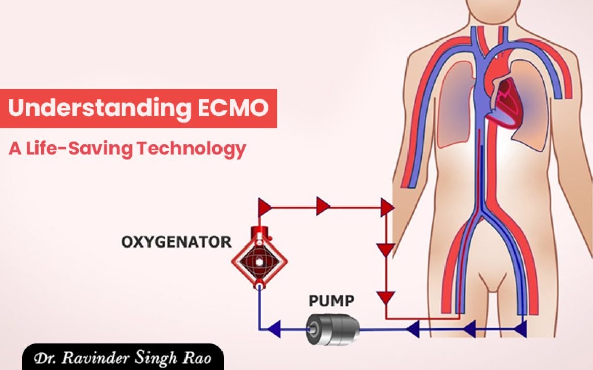 Understanding ECMO: A Life-Saving Technology