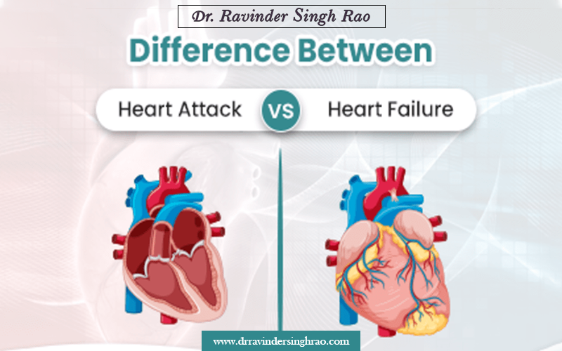 What is The Difference Between Heart Attack and Heart Failure