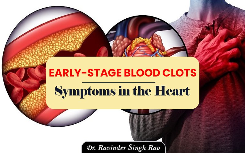 Early-Stage Blood Clots Symptoms in the Heart