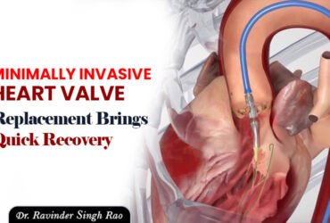 Minimally Invasive Heart Valve Replacement Brings Quick Recovery